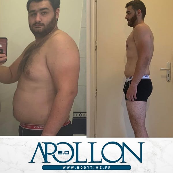 apollon avant apres
